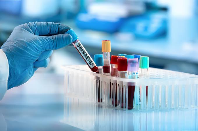 Lab Sample Collection